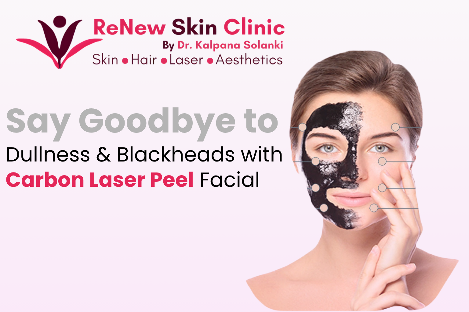 Dr. Kalpana Solanki performing Carbon Laser Peel Facial in Punjabi Bagh for glowing and clear skin treatment